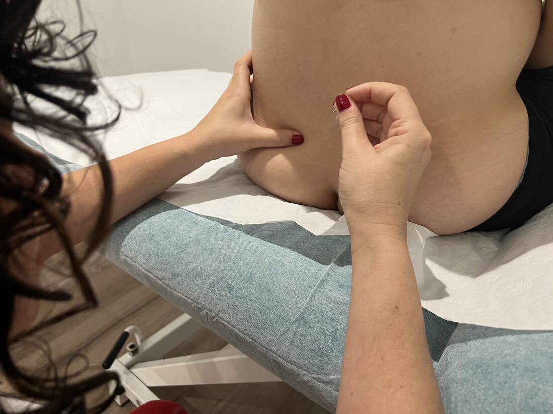 Acupuntura para el Embarazo. Embarazada
